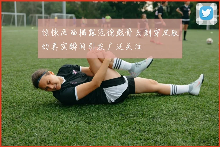 惊悚画面揭露范德彪骨头刺穿皮肤的真实瞬间引发广泛关注